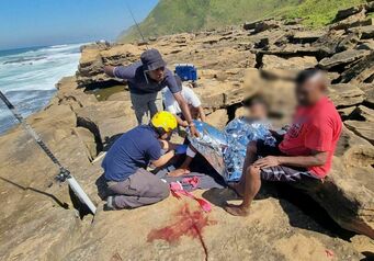 Durban angler breaks leg